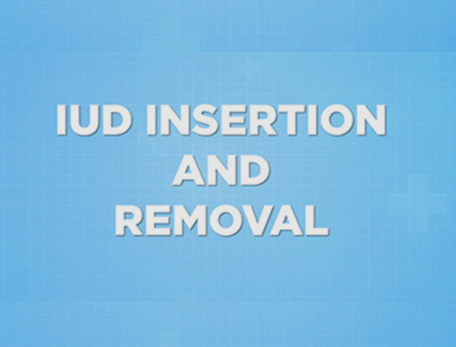 IUD insertion removal